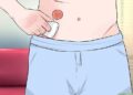 Keabsahan Salat Pengguna Kantong Stoma