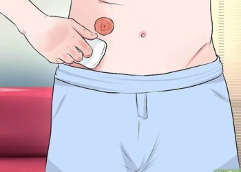 Keabsahan Salat Pengguna Kantong Stoma