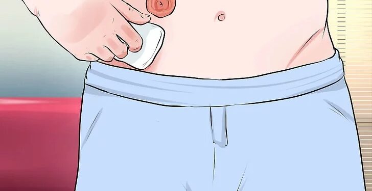 Keabsahan Salat Pengguna Kantong Stoma